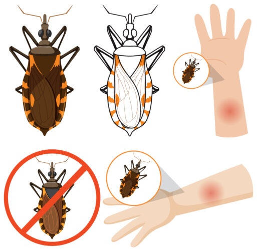 Human arm swollen from kissing bug bite illustration
клещи